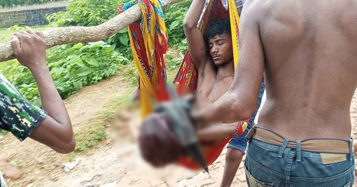বান্দরবানে সীমান্তে মাইন বিস্ফোরণে কিশোরের পা বিচ্ছিন্ন