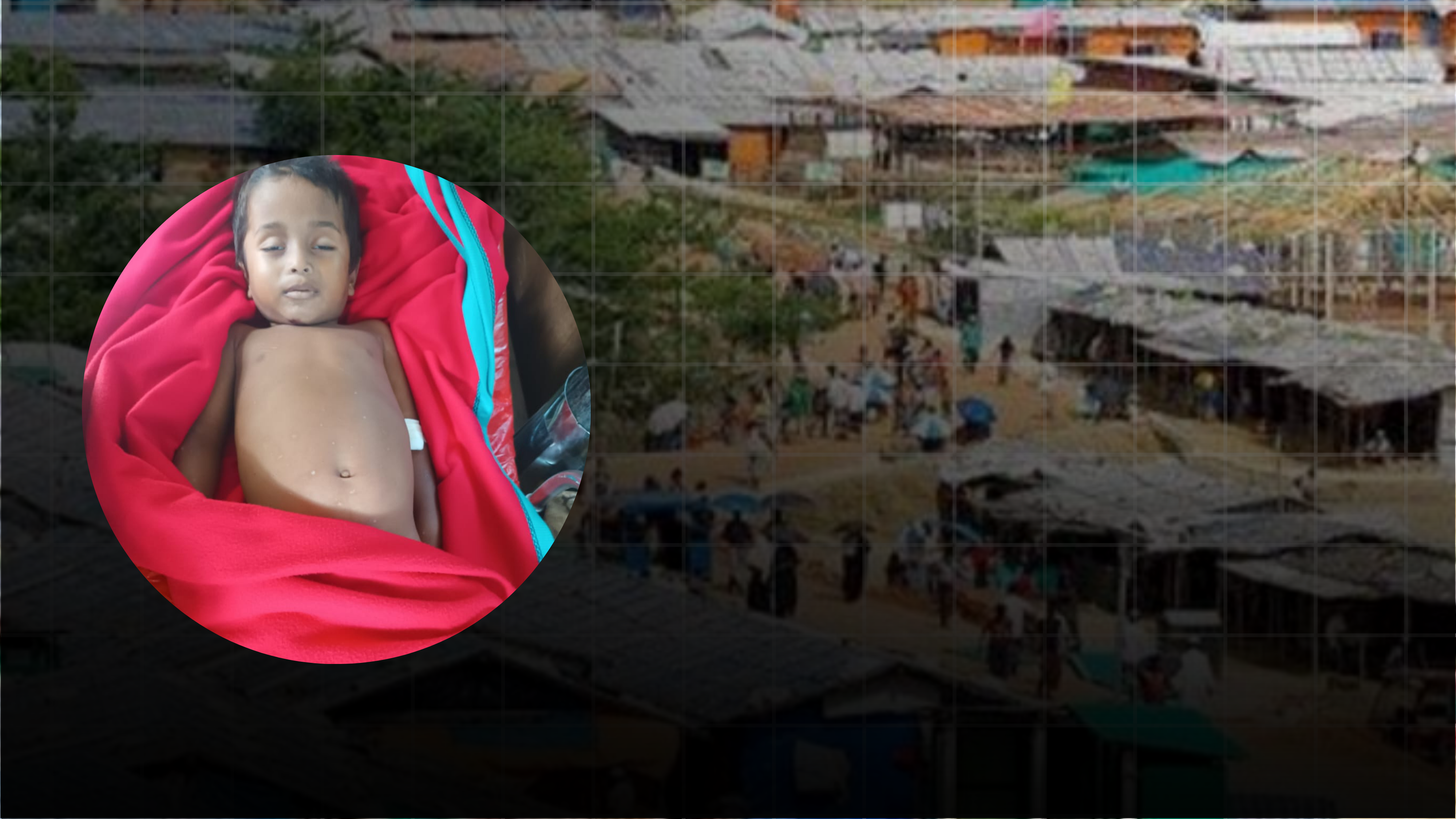 রোহিঙ্গা ক্যাম্পে অজ্ঞাত যানবাহনের ধাক্কায় শিশুর মৃত্যু
