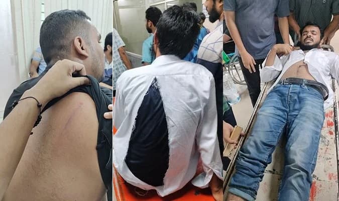 চট্টগ্রাম কলেজ ছাত্রদলের ৫ কর্মী আহত, হামলার অভিযোগ ছাত্রশিবিরের বিরুদ্ধে