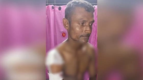 মিয়ানমারের নৌবাহিনীর গুলিতে বাংলাদেশি জেলে আহত