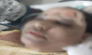 নগরের কোতোয়ালীতে গ্যাস সিলিন্ডার বিস্ফোরণে মা-ছেলে দগ্ধ