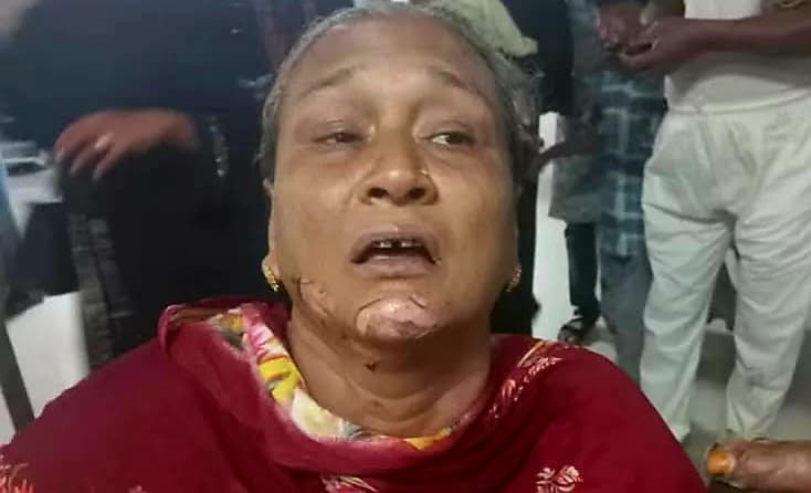চট্টগ্রামে চলন্ত অটোরিকশায় পেট্রোলবোমা হামলা, দগ্ধ ২ নারী