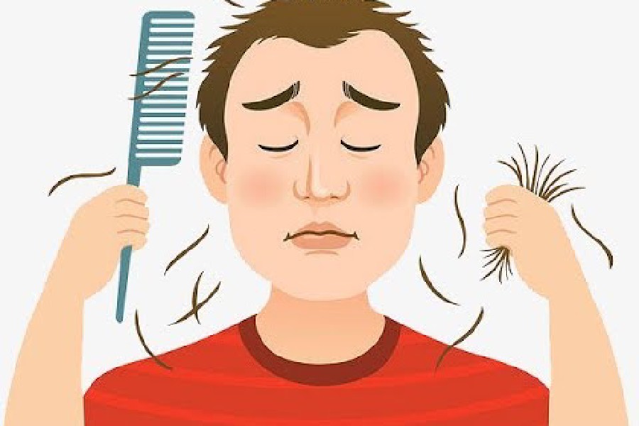 স্ট্রেসে বাড়ছে চুল পড়ার প্রবণতা