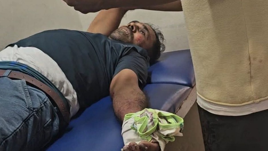 রাঙ্গুনিয়ায় এবি ট্রাভেলস এর চাপায় মোটরসাইকেল আরোহী আহত